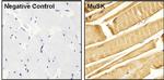 MUSK Antibody in Immunohistochemistry (Paraffin) (IHC (P))