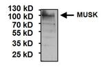 MUSK Antibody in Western Blot (WB)