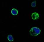 MUSK Antibody in Immunocytochemistry (ICC/IF)