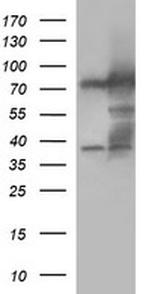 MUT Antibody in Western Blot (WB)