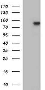 MUT Antibody in Western Blot (WB)