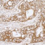 MVP/Major Vault Protein Antibody in Immunohistochemistry (IHC)