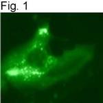 Myc Tag Antibody in Immunocytochemistry (ICC/IF)