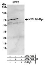 MYCL1/L-Myc Antibody in Immunoprecipitation (IP)