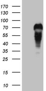 MYCN Antibody in Western Blot (WB)