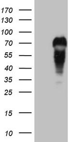 MYCN Antibody in Western Blot (WB)