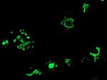 MYD88 Antibody in Immunocytochemistry (ICC/IF)