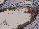 MYD88 Antibody in Immunohistochemistry (Paraffin) (IHC (P))