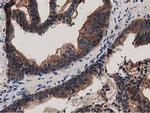 MYD88 Antibody in Immunohistochemistry (Paraffin) (IHC (P))