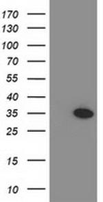 MYD88 Antibody in Western Blot (WB)