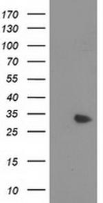 MYD88 Antibody in Western Blot (WB)