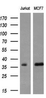 MYD88 Antibody in Western Blot (WB)