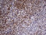 MYF5 Antibody in Immunohistochemistry (Paraffin) (IHC (P))