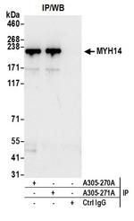 MYH14/Myosin-14 Antibody in Western Blot (WB)