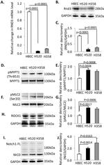 Phospho-MYL9 (Thr18, Ser19) Antibody in Western Blot (WB)