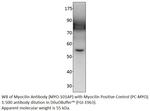 Myocilin Antibody in Western Blot (WB)