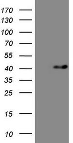 MYOZ1 Antibody in Western Blot (WB)