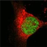 MYST1 Antibody in Immunocytochemistry (ICC/IF)