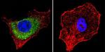 IGF2R Antibody in Immunocytochemistry (ICC/IF)