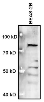 MECP2 Antibody in Western Blot (WB)