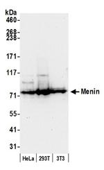 Menin Antibody in Western Blot (WB)