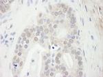 Menin Antibody in Immunohistochemistry (IHC)