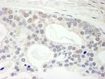 Menin Antibody in Immunohistochemistry (IHC)