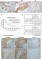 Metadherin Antibody in Immunohistochemistry (IHC)