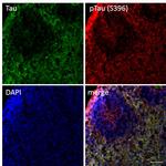 Mouse IgG (H+L) Secondary Antibody in Immunohistochemistry (Frozen) (IHC (F))