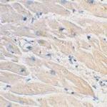 MyD88 Antibody in Immunohistochemistry (Paraffin) (IHC (P))