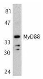 MyD88 Antibody in Western Blot (WB)