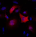 Myc Tag Antibody in Immunocytochemistry (ICC/IF)