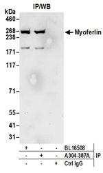 Myoferlin Antibody in Western Blot (WB)