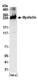 Myoferlin Antibody in Western Blot (WB)