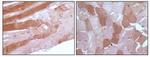 Myoglobin Antibody in Immunohistochemistry (Paraffin) (IHC (P))