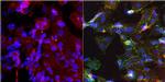 N-cadherin Antibody in Immunocytochemistry (ICC/IF)