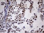 N4BP2L2 Antibody in Immunohistochemistry (Paraffin) (IHC (P))