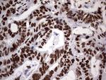 N4BP2L2 Antibody in Immunohistochemistry (Paraffin) (IHC (P))