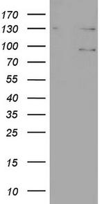 N4BP2L2 Antibody in Western Blot (WB)