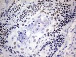 NAB1 Antibody in Immunohistochemistry (Paraffin) (IHC (P))