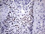 NAB1 Antibody in Immunohistochemistry (Paraffin) (IHC (P))