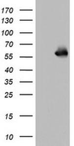 NAB1 Antibody in Western Blot (WB)