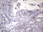 NAB2 Antibody in Immunohistochemistry (Paraffin) (IHC (P))