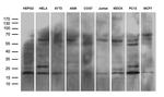 NABP1 Antibody in Western Blot (WB)