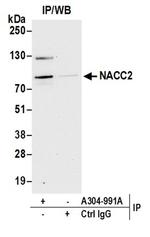 NACC2/BTBD14A Antibody in Western Blot (WB)