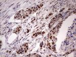 NAE1 Antibody in Immunohistochemistry (Paraffin) (IHC (P))