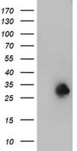 NANP Antibody in Western Blot (WB)