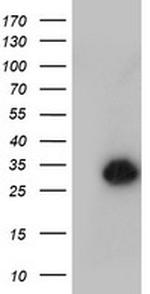 NANP Antibody in Western Blot (WB)