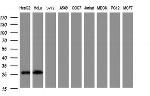 NANP Antibody in Western Blot (WB)