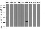 NANP Antibody in Western Blot (WB)